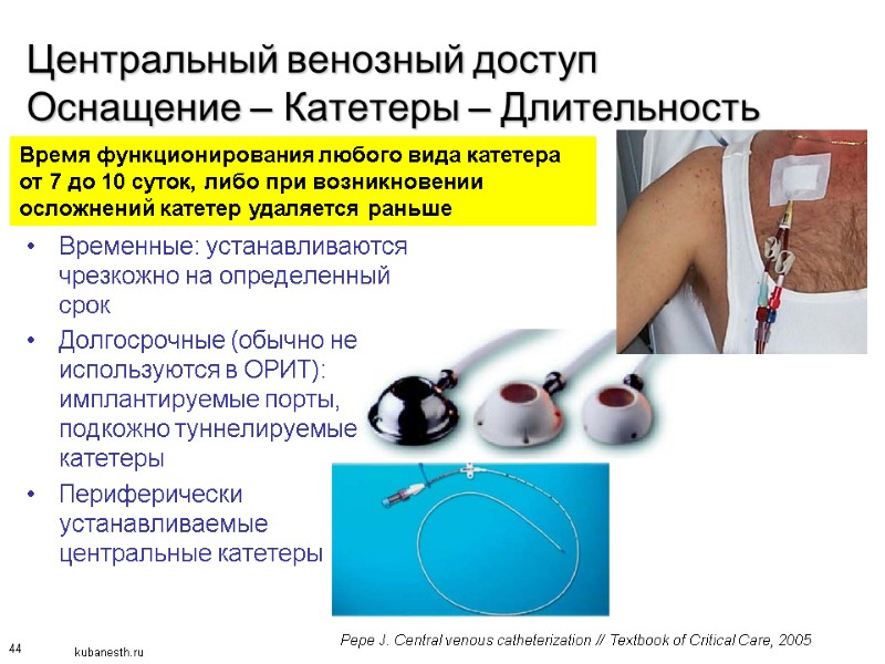 44 Центральный венозный доступ Оснащение – Катетеры – Длительность    Временные: устанавливаются